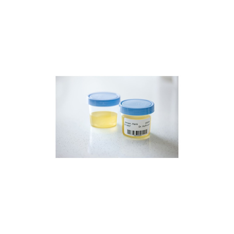 Dymo LabelWriter ORIGINAL Vielzwecketiketten 32x57mm, 1 Rolle mit 1000 Etiketten(weiß, wieder ablösbar, S0722540)